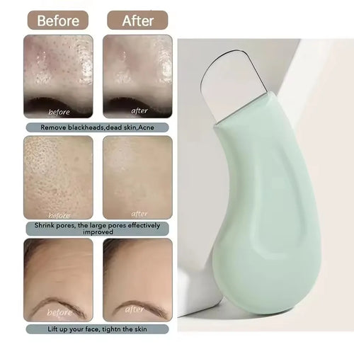1 pièce — Outil d’extraction des points noirs et points blancs pour le nez et le visage, nettoyeur de pores de la peau, accessoire de soin du visage pour femmes, élimination des points noirs et nettoyage des pores.