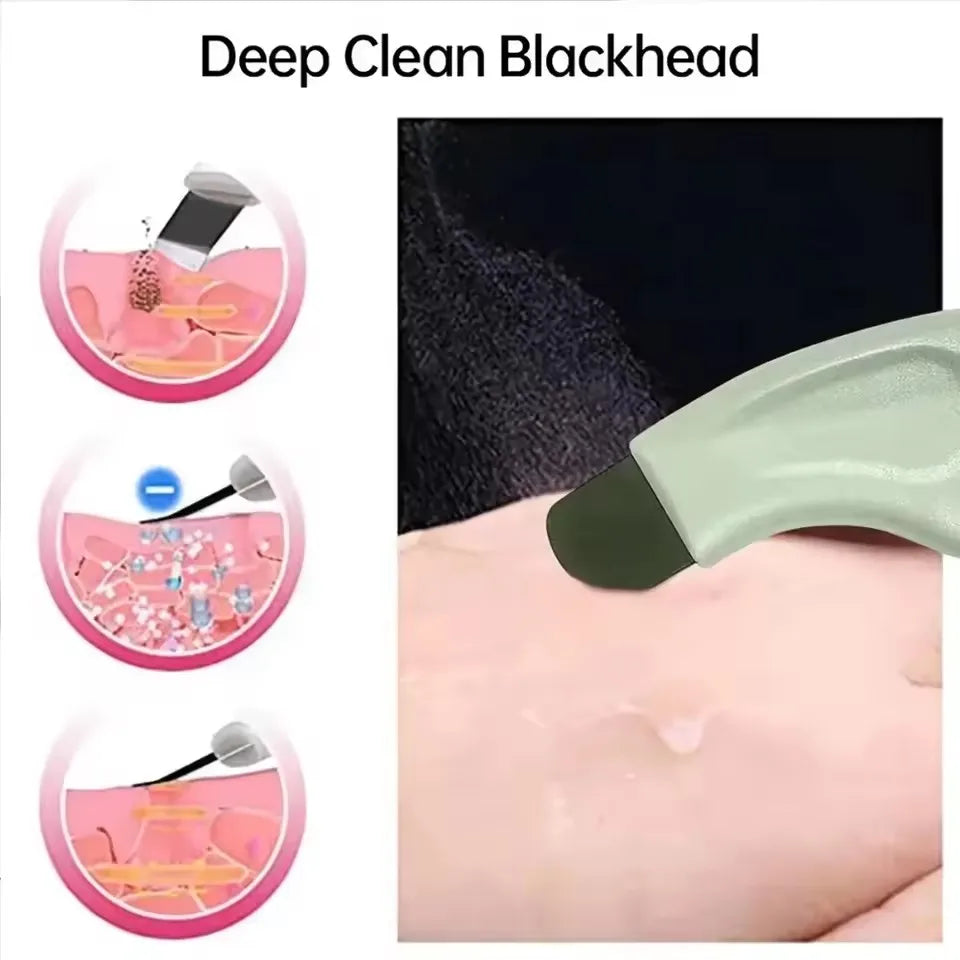 1 pièce — Outil d’extraction des points noirs et points blancs pour le nez et le visage, nettoyeur de pores de la peau, accessoire de soin du visage pour femmes, élimination des points noirs et nettoyage des pores.